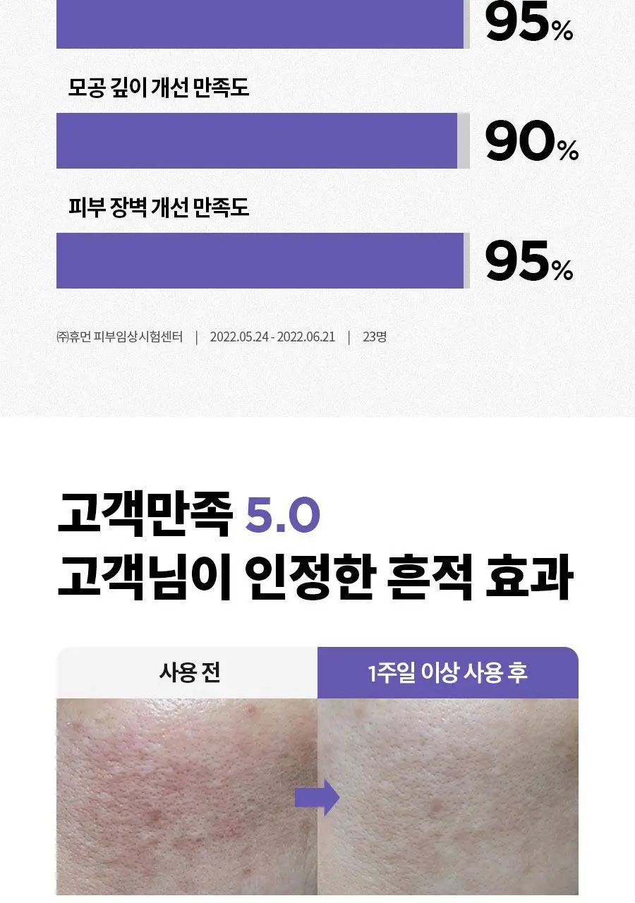 [NCT 재민PICK] 이즈앤트리 어니언 뉴페어 클리어 패드 60매 (+20매 리필 증정기획) 상세페이지 32